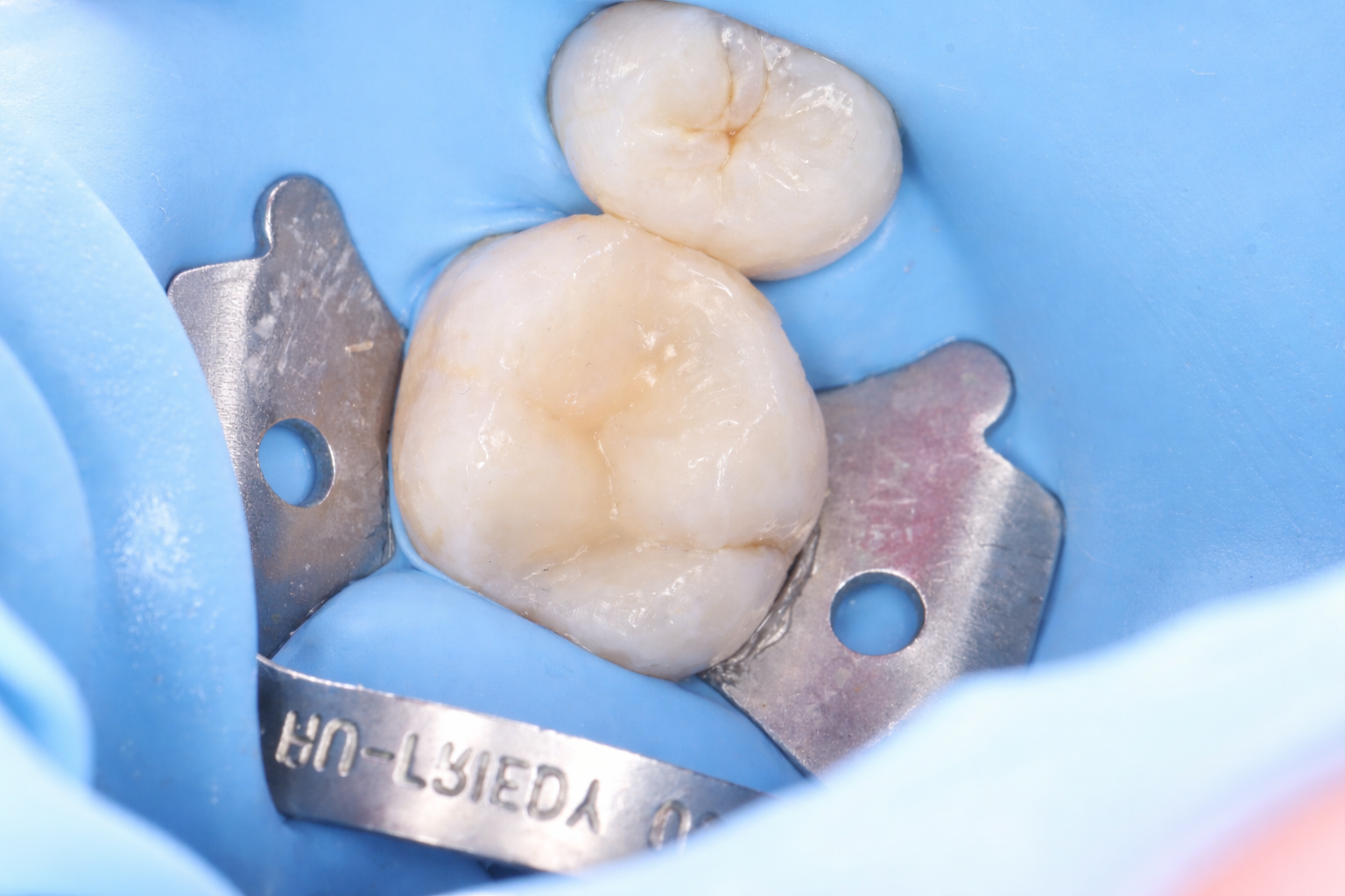 Rehabilitación Oral